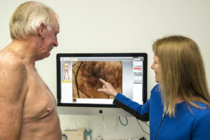 Sequential Digital Dermoscopy Imaging - SDDI